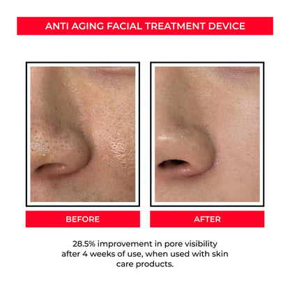 VibeWell ReLift 6-in-1 – EMS & LED för hudlyft och förnyelse